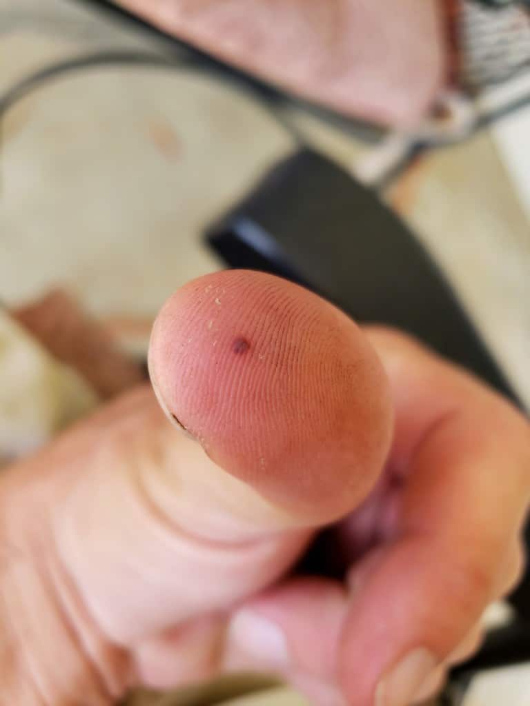 Green thumb or blood blister from the metal screws: gloves advised