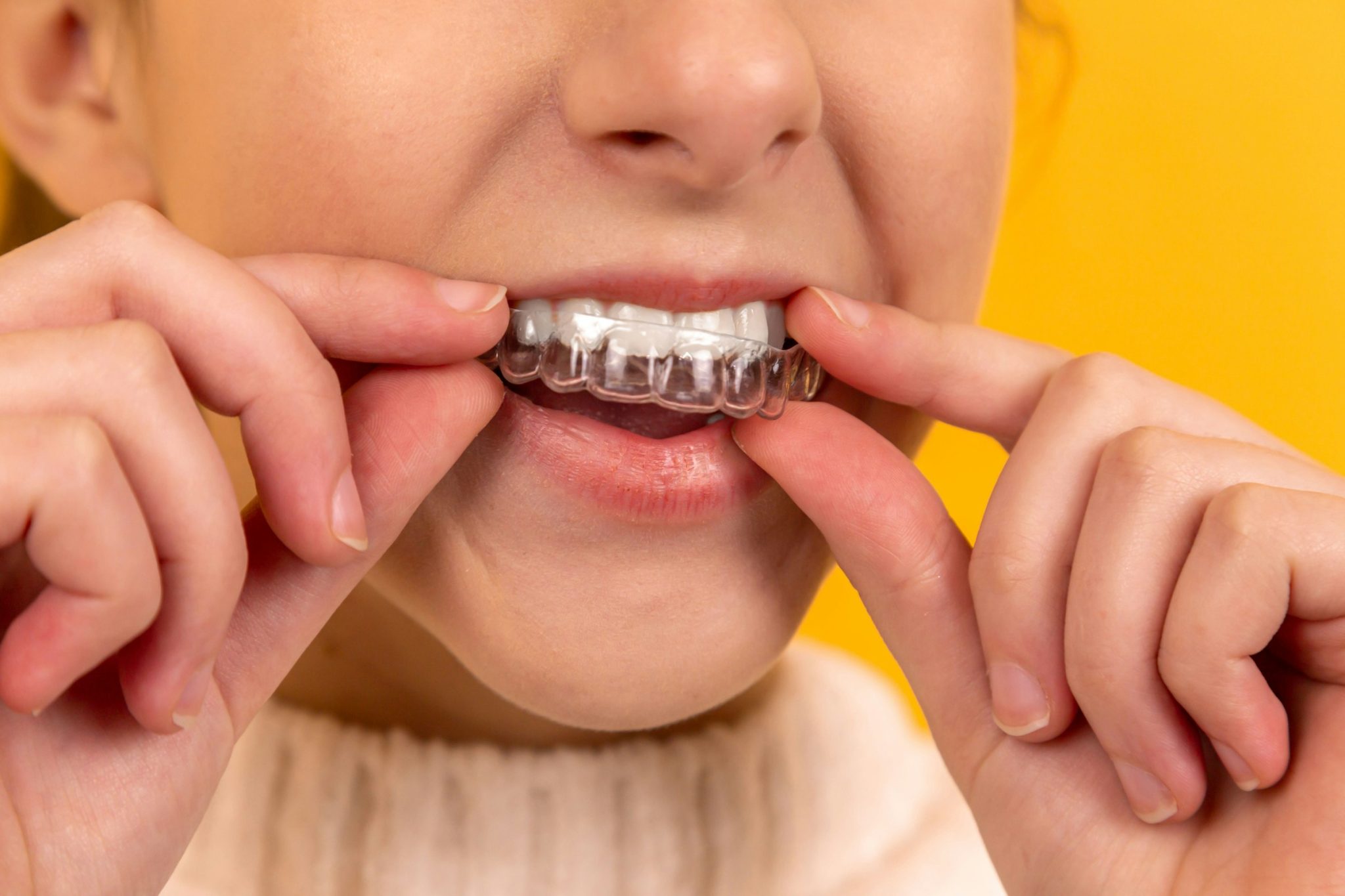 How can you fix your crooked teeth without braces at home