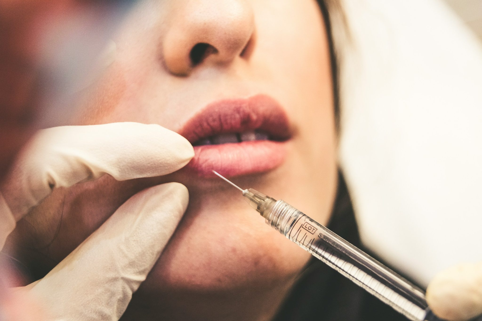 From vials to pre-filled syringes: the evolution of ha fillers
