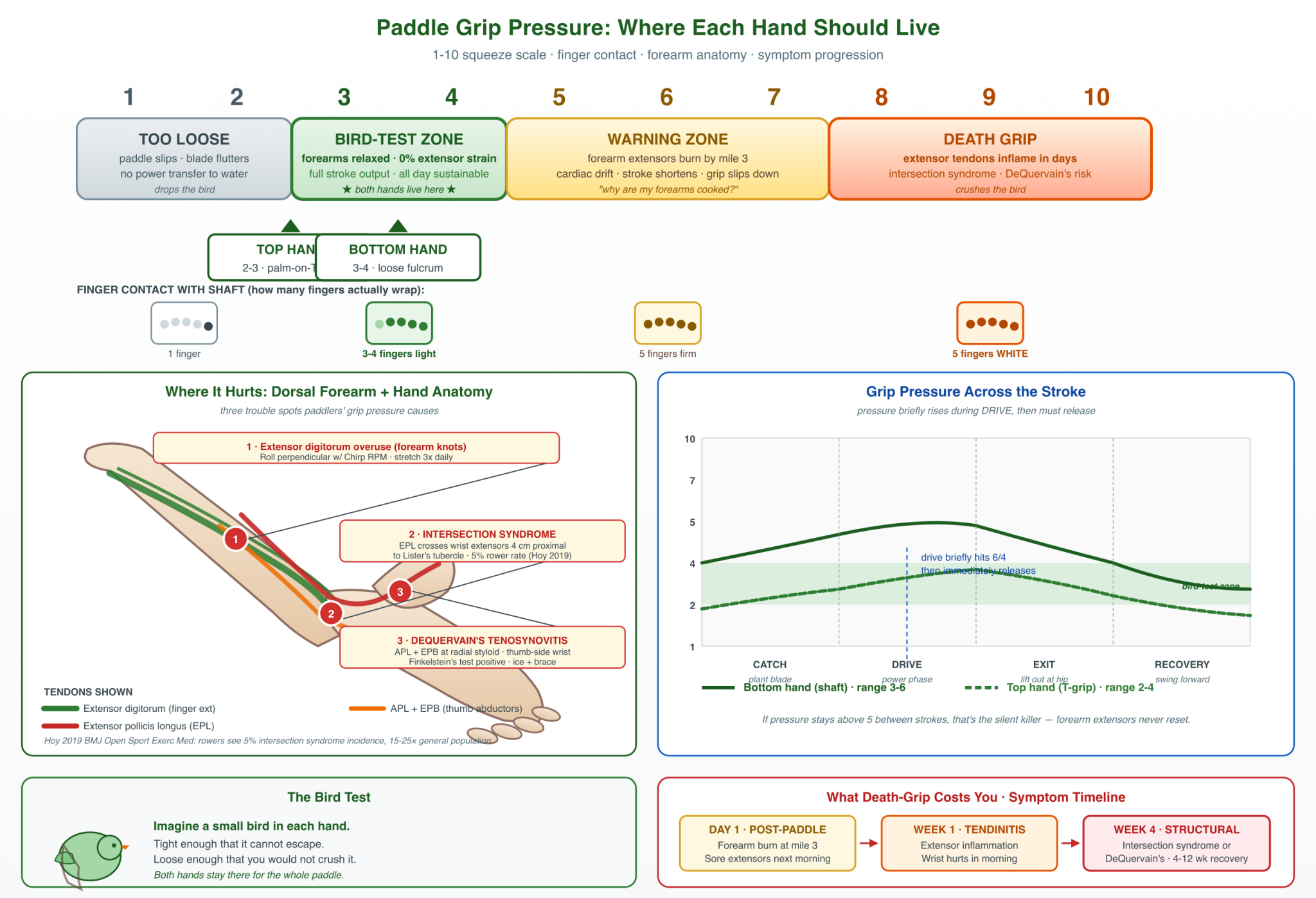 1-to-10 grip pressure scale showing four zones (too loose, bird-test optimal at 3-4, warning, death grip), top-hand and bottom-hand position markers, finger-contact visualization per zone, dorsal forearm anatomy with intersection syndrome and dequervain's locations, stroke-phase pressure chart, bird-test analogy, and 3-stage symptom progression timeline.