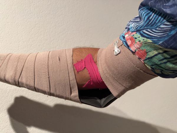 Right arm in an elastic wrap over a rigid splint, with pink kinesiology tape at the front of the elbow