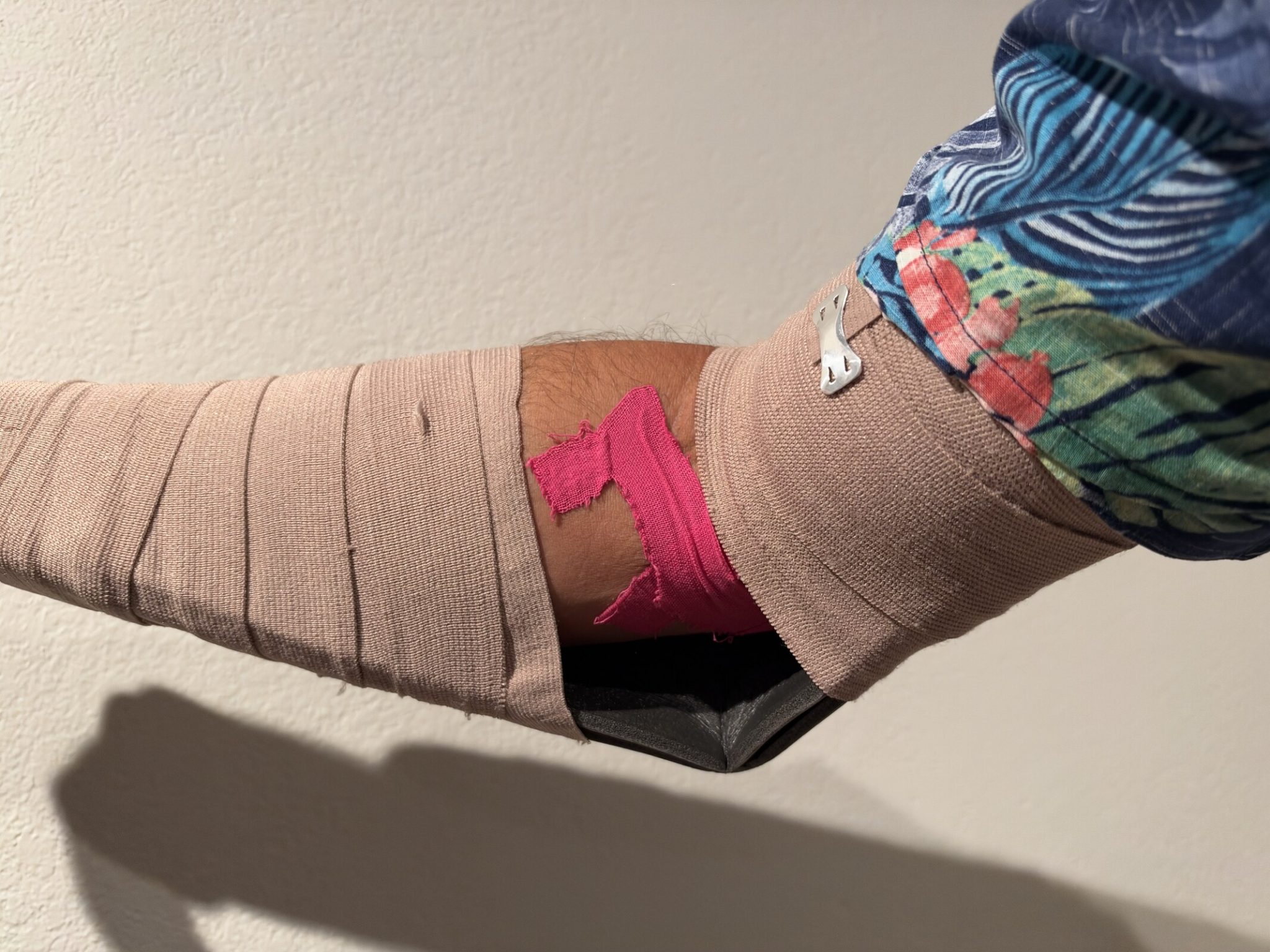 Right arm in an elastic wrap fastened with a metal clip over a rigid splint, with pink kinesiology tape visible at the front of the elbow
